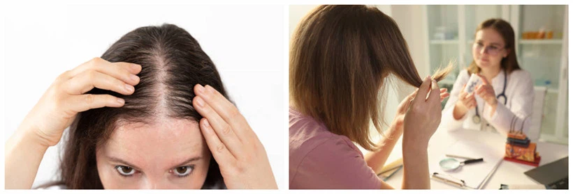 hair loss problem hair loss problem